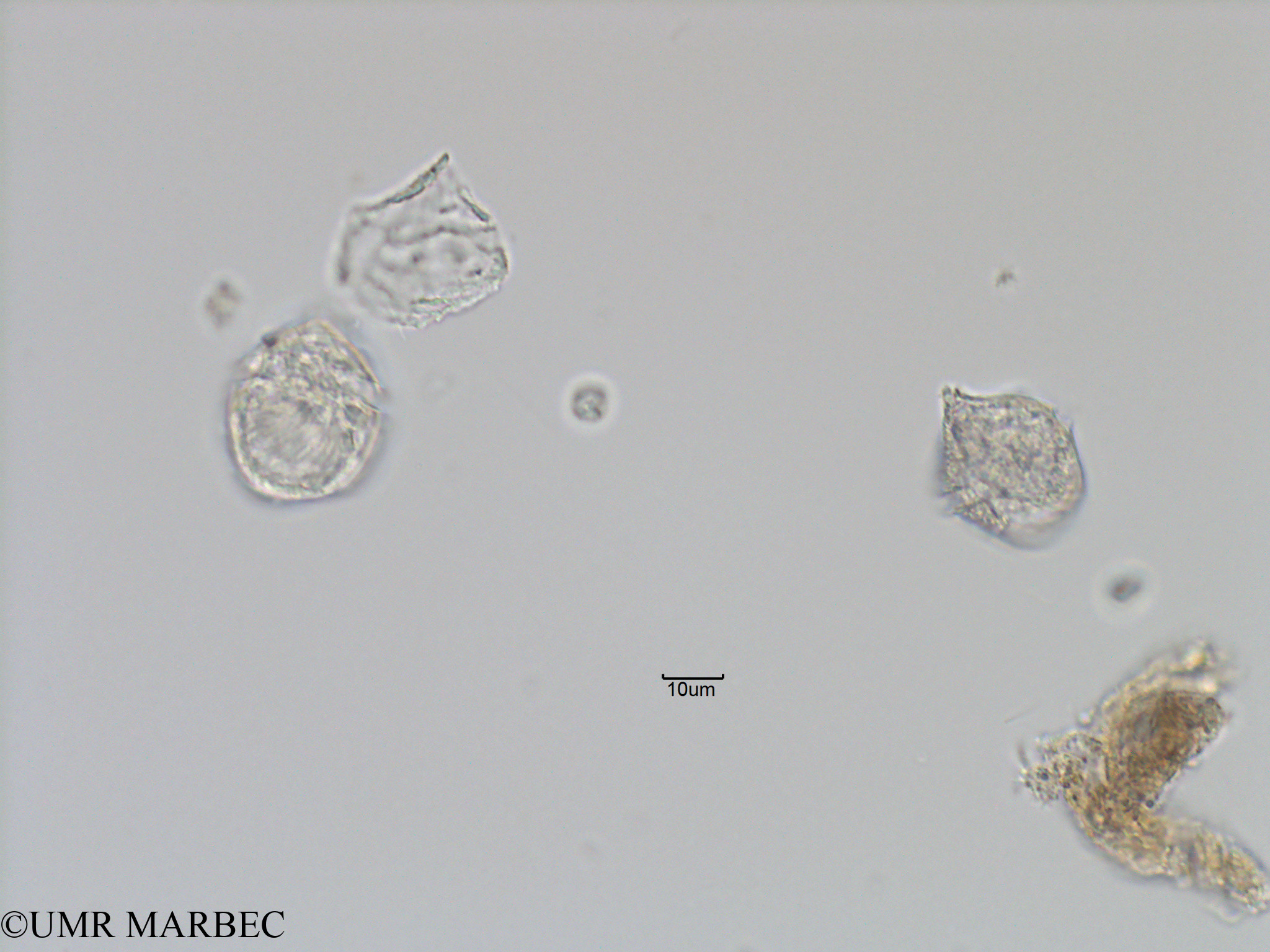 phyto/Bizerte/bizerte_bay/RISCO November 2015/Gonyaulax sp12 et Dino 43 (Baie_T5-C2-Protoceratium cf reticulatum et dino a identifier-20).tif(copy).jpg